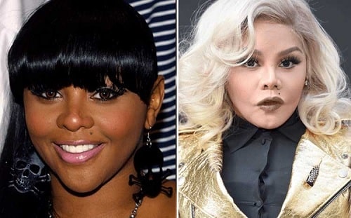 A picture of Lil' Kim before and after.